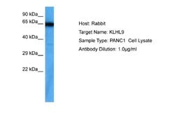 KLHL9 Antibody, Novus Biologicals 100 &mu;L; Unconjugated:Antibodies, Polyclonal